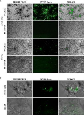 Extracellular Nucleic Acids Present in the Candida albicans Biofilm Trigger the Release of Neutrophil Extracellular Traps